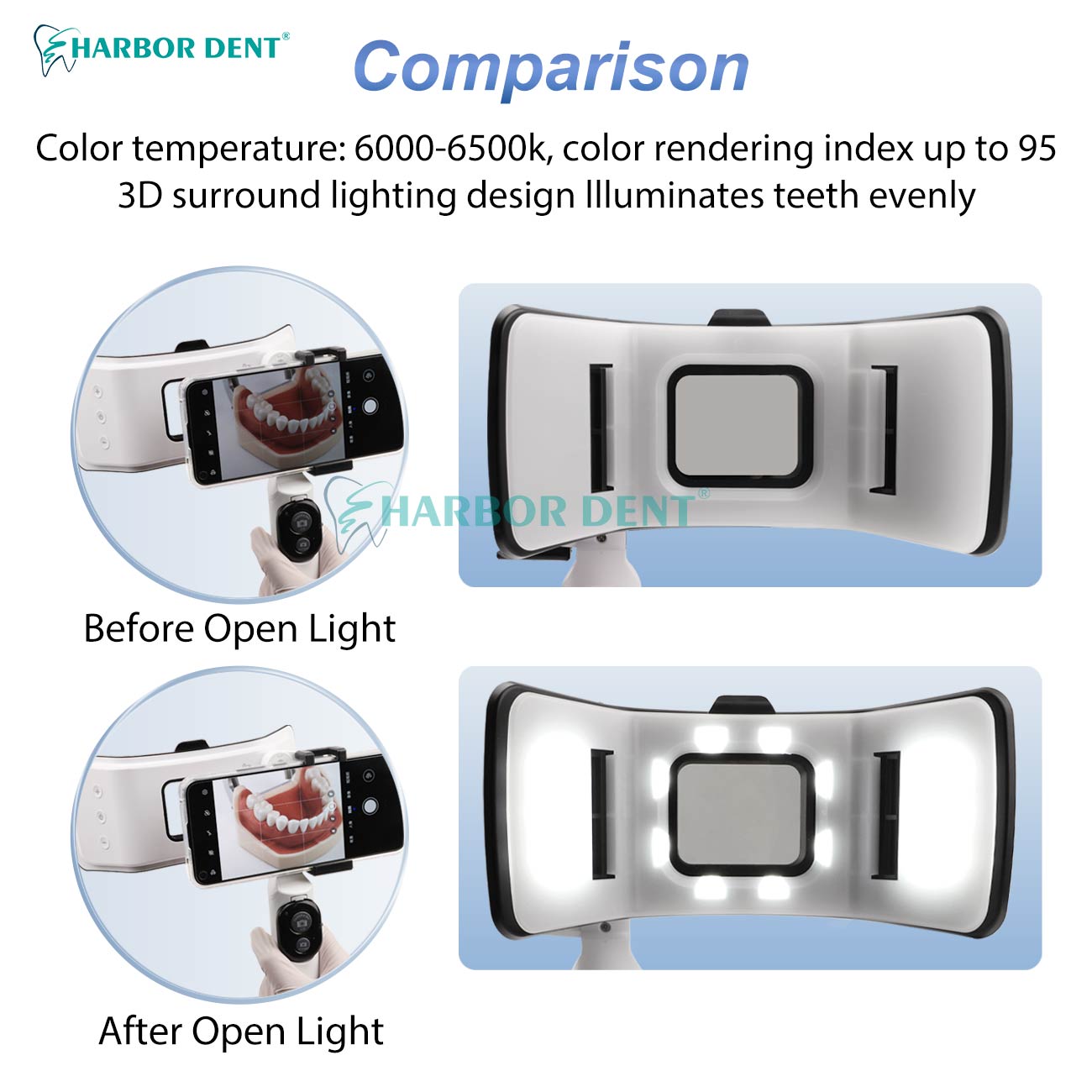 Good Price Dental Photography  – обзор и цена Good Lighting In Photography